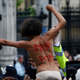 Illustration for article titled 70 Million More Women and Girls Than Previously Thought Have Undergone Genital Mutilation
